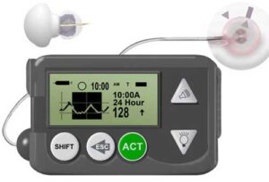 جهاز المراقبة المستمرة لسكر الدم المستخدم في مراقبة سكر الدم لمرضى السكري بصورة تلقائية